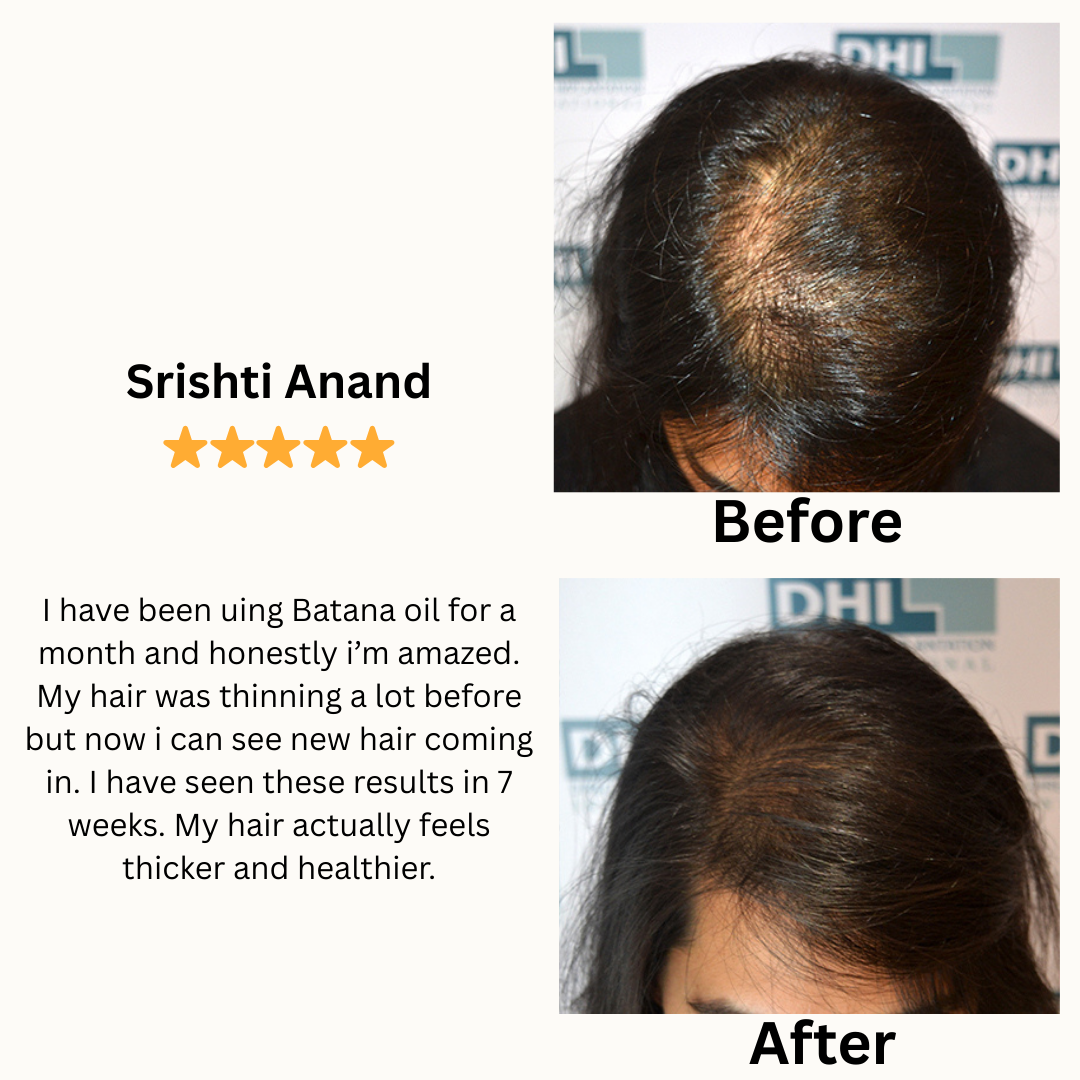 Batana Hair Growth Oil - Increased hair growth in just 6 weeks