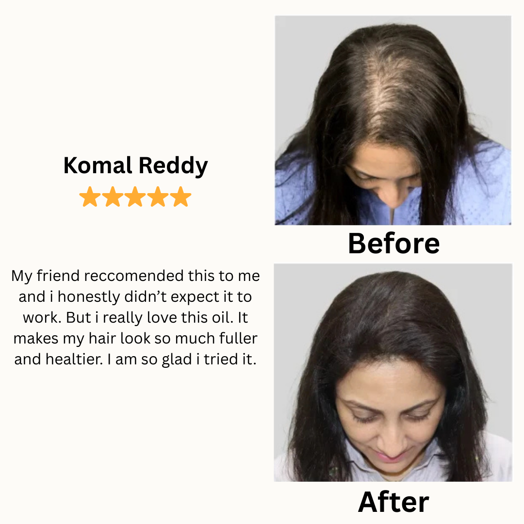 Batana Hair Growth Oil - Increased hair growth in just 6 weeks