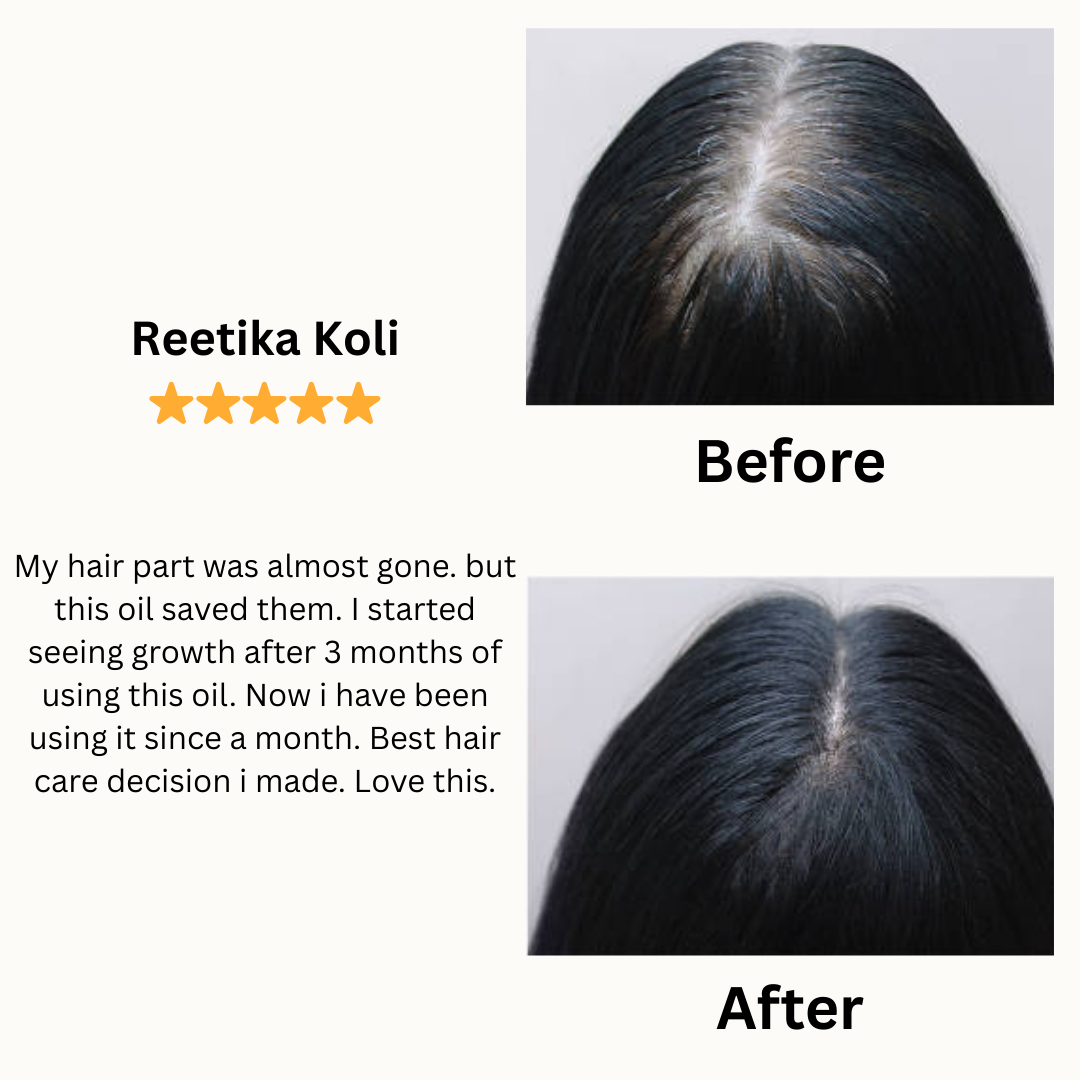 Batana Hair Growth Oil - Increased hair growth in just 6 weeks