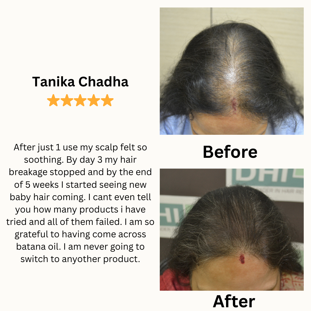 Batana Hair Growth Oil - Increased hair growth in just 6 weeks